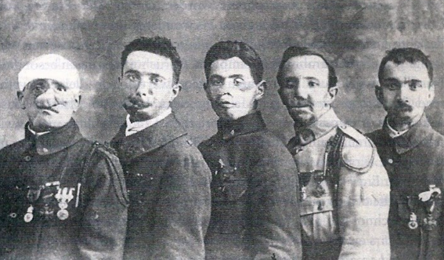 Française des jeux : photo de gueules cassées